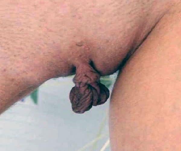 Frauen mit langen Schamlippen